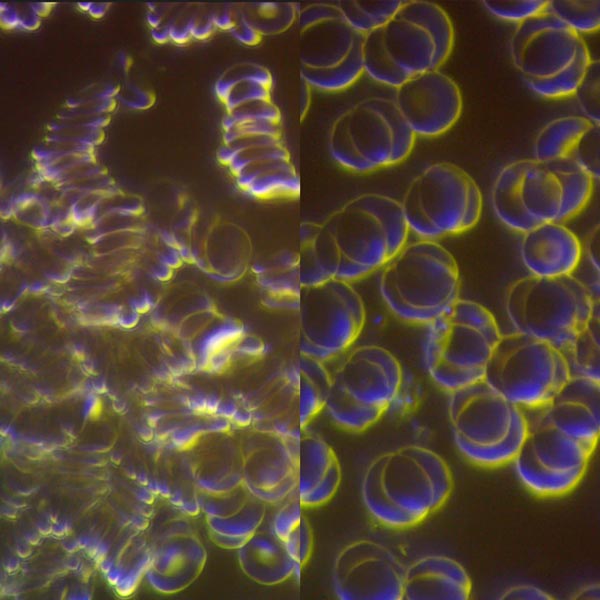 How Healthy Cells Look Before & After PEMF