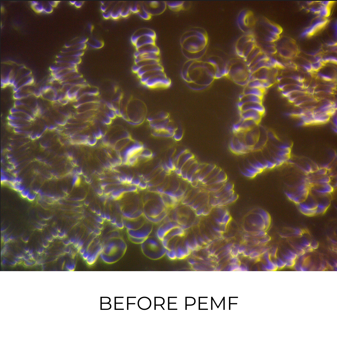 Live blood analysis of cells before a PEMF session